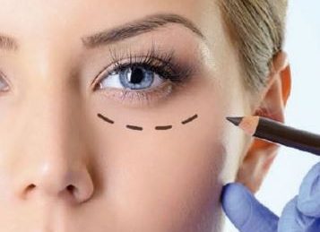Όλα όσα πρέπει να γνωρίζετε για το Facelift!