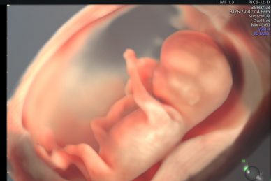 LIVE DEMONSTRATION: ΜΑΙΕΥΤΙΚΕΣ ΕΦΑΡΜΟΓΕΣ ΤΡΙΣΔΙΑΣΤΑΤΗΣ ΥΠΕΡΗΧΟΓΡΑΦΙΑΣ