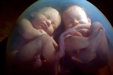 ΕΠΙΣΤΗΜΟΝΙΚΗ ΔΙΑΛΕΞΗ 25-11