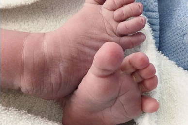 ΣΥΝΕΡΓΑΣΙΑ ΚΛΙΝΙΚΗΣ ΡΕΑ & HOPEgenesis:  ΔΙΠΛΑ ΣΤΙΣ ΕΓΚΥΟΥΣ ΑΠΟΜΑΚΡΥΣΜΕΝΩΝ ΠΕΡΙΟΧΩΝ